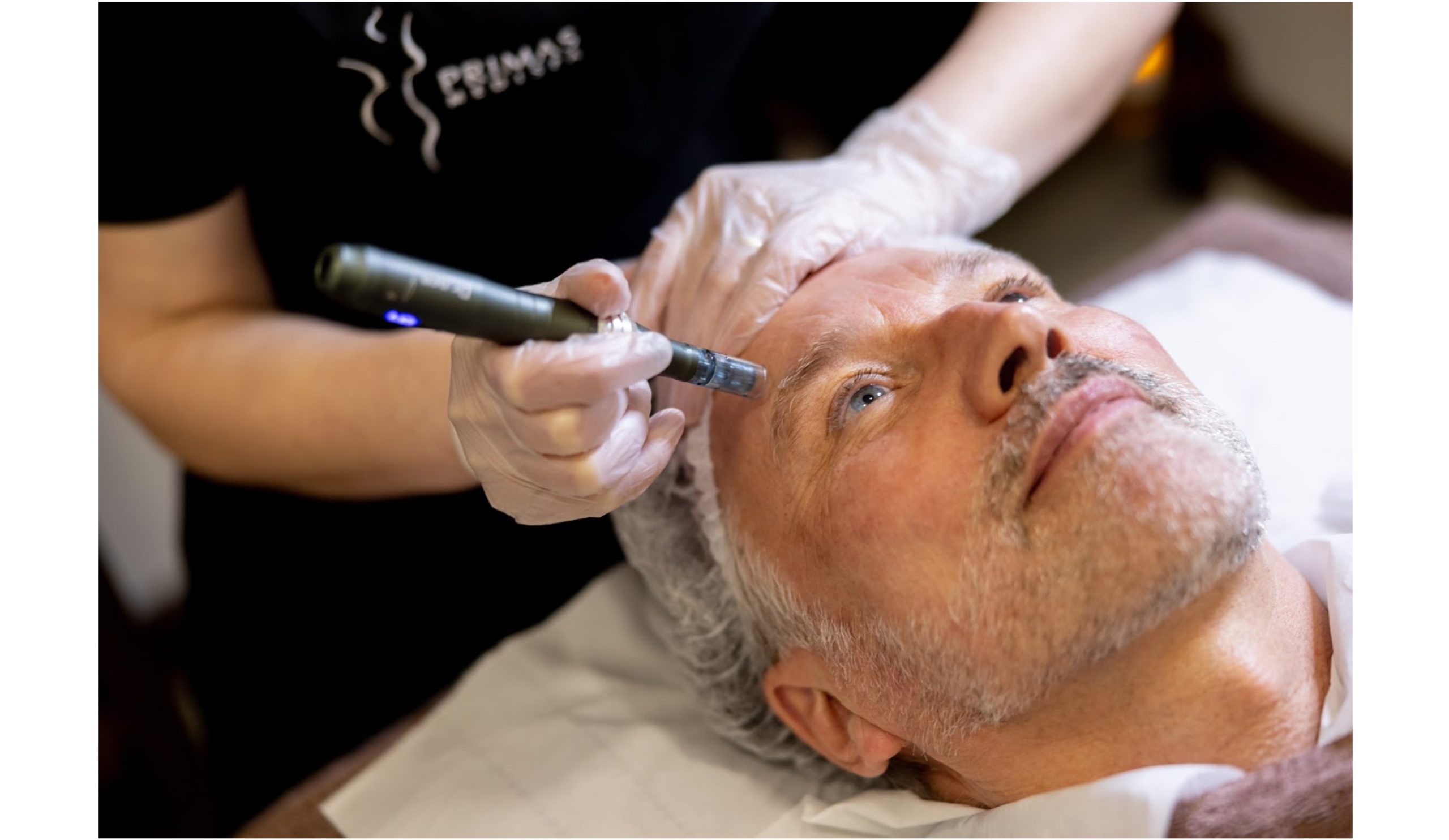 Laser Skin Resurfacing