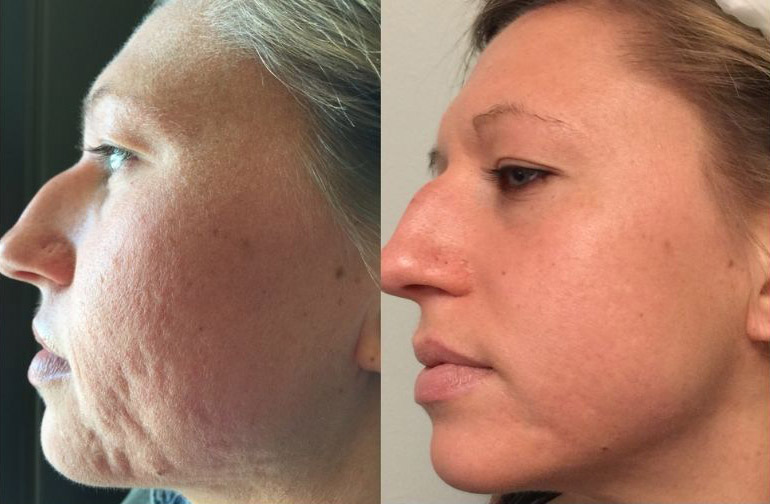 Targeted Skin Concerns