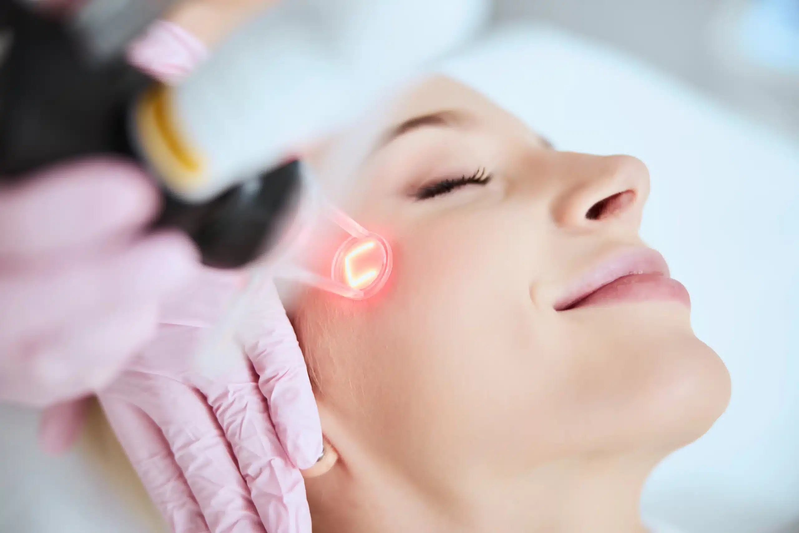 Reversing Sun Damage With Laser Therapy