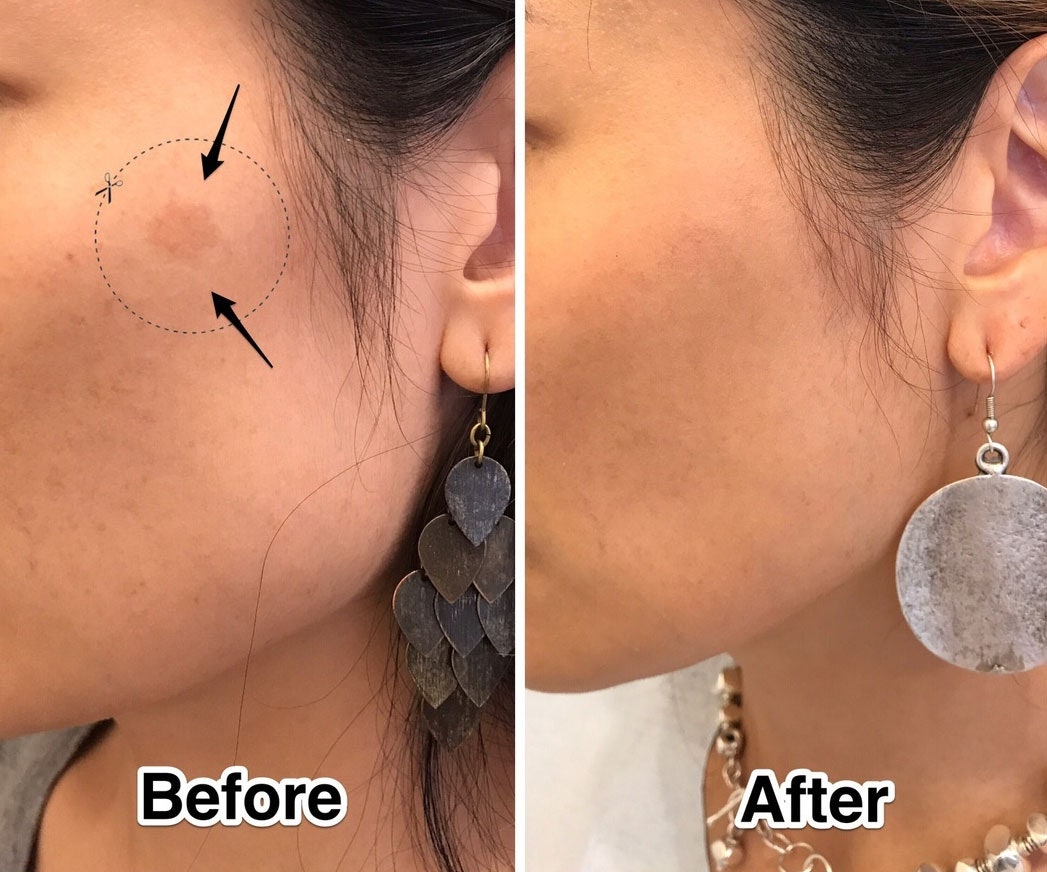 Post-Treatment Care and Maintenance