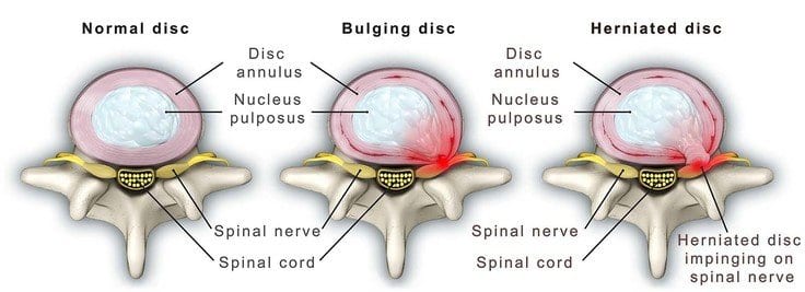 Clinique TAGMED – Premier Clinic for Sciatica Treatment